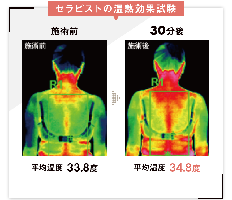 セラピストの温熱効果試験
